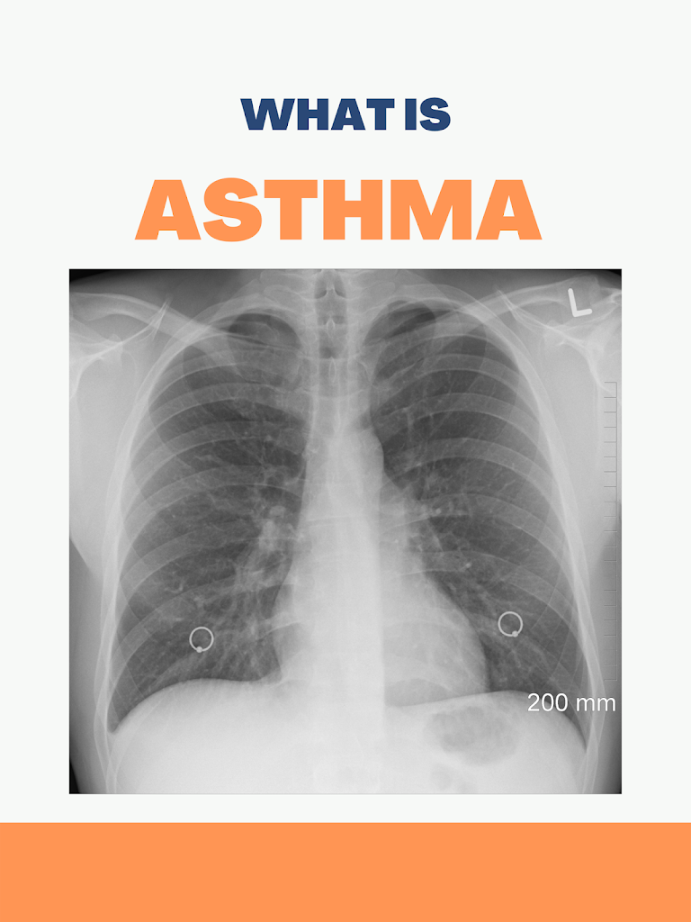 symptoms-of-asthma-causes-prevention